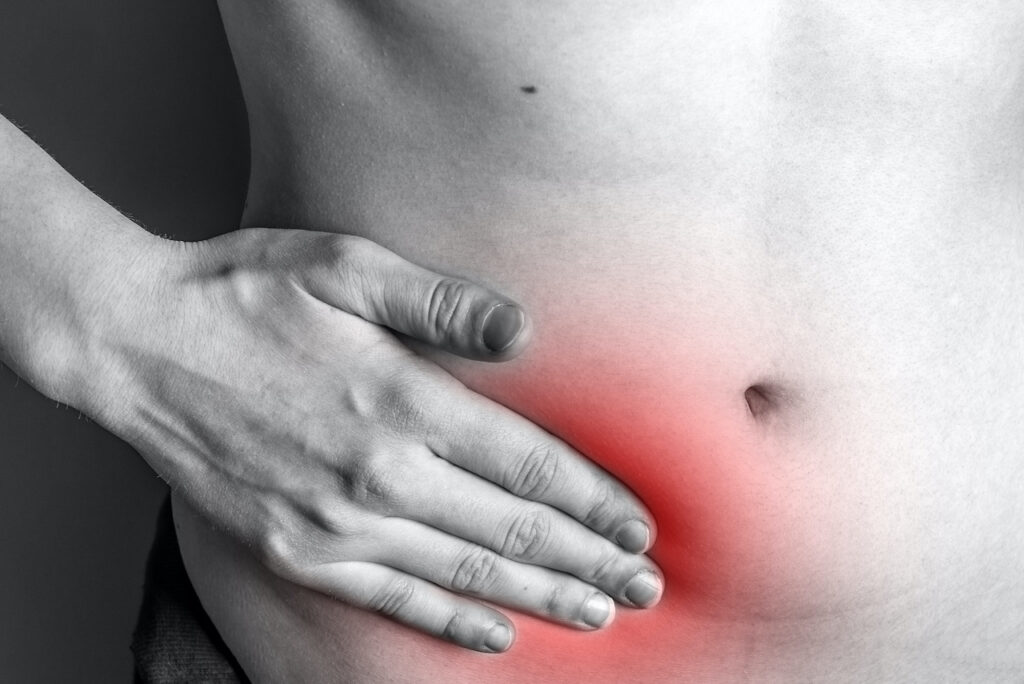 appendicitis